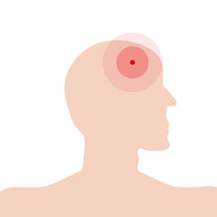 Profile, silhouette of a person's head with a schematic image of a headache, migraine