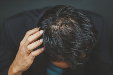 Men have problems with hair loss, thinning hair, baldness
