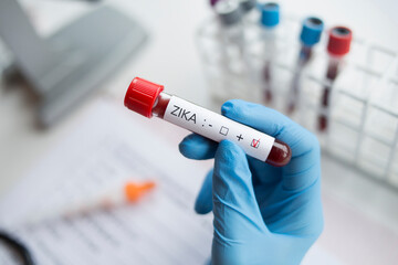 Fototapeta premium Laboratory: Blood sample positive with ZIKA virus.