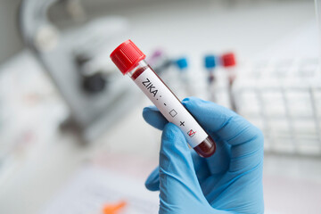 Fototapeta premium Laboratory: Blood sample positive with ZIKA virus.