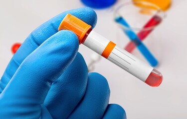 Scientist hand with tube sample in laboratory