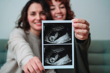 Happy gay lesbian couple holding ultrasound photo scan at home - Lgbtq surrogate pregnancy concept - obrazy, fototapety, plakaty