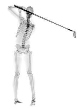 3d rendered medically accurate illustration of a golf player x-ray