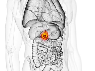 3d rendered medically accurate illustration of the gallbladder cancer