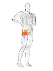 3d rendered medically accurate illustration of a man having a painful shoulder joint