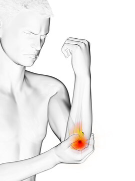 3d rendered medically accurate illustration of a man with painful elbow