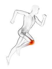3d rendered medically accurate illustration of a runners painful knee