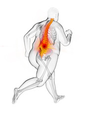 3d rendered medically accurate illustration of an obese runners painful back