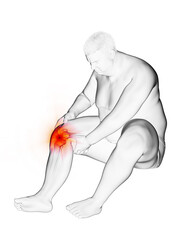 Naklejka premium 3d rendered medically accurate illustration of an obese mans painful knee