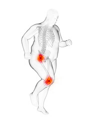 3d rendered medically accurate illustration of an obese runners painful joints