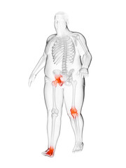 3d rendered medically accurate illustration of an obese runners painful joints