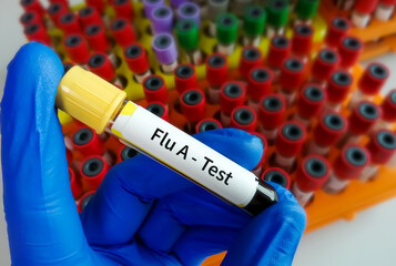 Blood Sample for Flu A test. influenza virus.