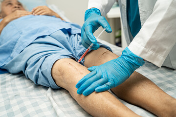 Asian doctor inject Hyaluronic acid platelet rich plasma into the knee of senior woman to walk...