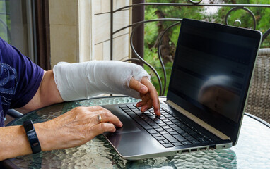 Woman hand in white plaster cast is working on a computer. A freelancer with one broken wrist...