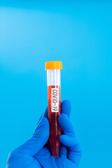 Hand holding blood test tube with word COVID-19