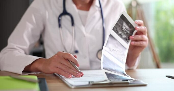 Female doctor holds results of ultrasound scan of uterus in hands
