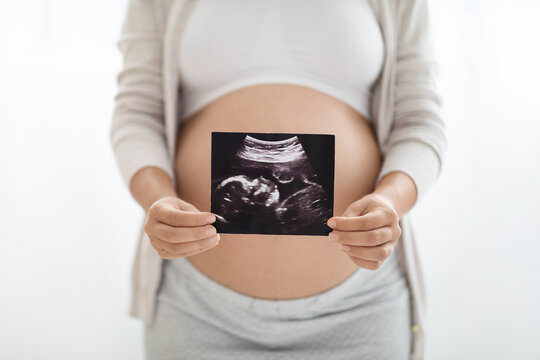 Cropped of expecting woman showing baby ultrasound image