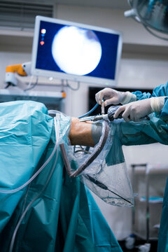 Crop surgeon conducting surgery through knee
