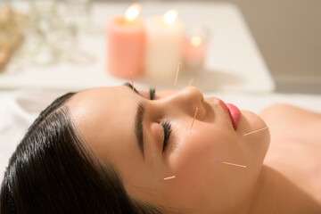 Beautiful Woman Received acupuncture treatment on face by  therapist, chinese medicine treatment,...