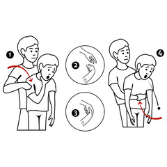 Heimlich's maneuver. First aid procedure for choking due to obstruction of the upper respiratory tract by foreign bodies. Vector flat illustration