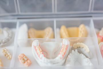 Fototapeta na wymiar dental prostheses of different characteristics, dental health concept