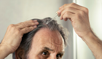 Old man dropping serum onto his hair