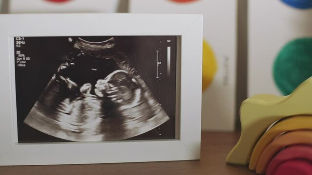 Close up of an ultrasound printed out sitting on a shelf