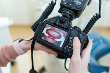 photographer photographing client's teeth in dentistry