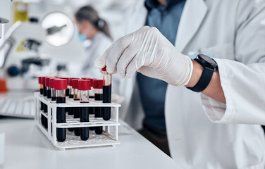Scientist, science and dna blood sample test tube in pathology lab with gloves doing research and...