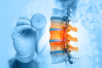 Orthopaedics doctors examining human spine. lower back pain. Spine disease. 3d illustration