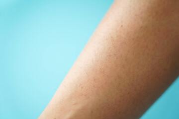 Close-up of hairy skin. Hair on women's legs. No epilation on the leg.