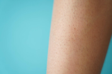 Close-up of hairy skin. Hair on women's legs. No epilation on the leg.