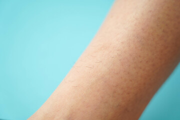 Close-up of hairy skin. Hair on women's legs. No epilation on the leg.
