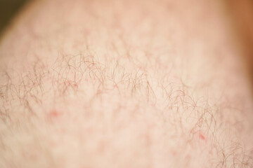 Close-up of hairy skin. Hair on a man's leg