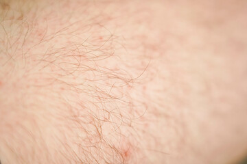 Close-up of hairy skin. Hair on a man's leg
