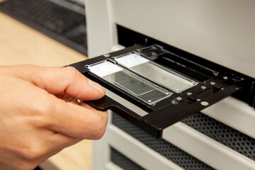 Scientist scanning microscope slides with tissue samples for pathology studies. Cancer diagnosis...