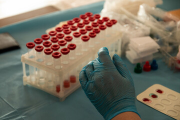 donor's day. a nurse in blue latex gloves takes a blood sample from a patient. medical blood jars. charity donation red cross