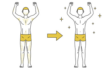 医療脱毛のイメージ、体毛が濃くて悩んでいる男性が脱毛してつるつるになるビフォーアフター