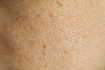 Fototapeta premium Texture of human skin as background, closeup view