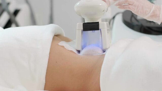 Сryolipolysis fat treatment procedure in the modern cosmetology clinic