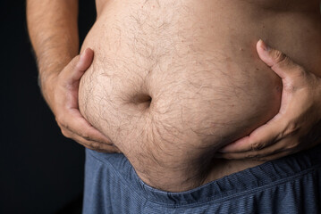 Man touches his fat belly with both hands