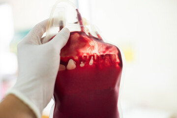 Blood bag in hand scientis.