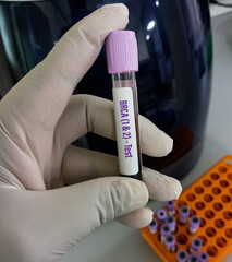 Blood sample for BRCA1 and BRCA2 are two genes that are important to fighting cancer called tumor...