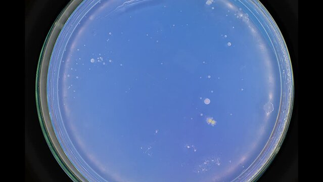 growth of bacteria in a petri dish samples taken in the trading floor of the store timelapse