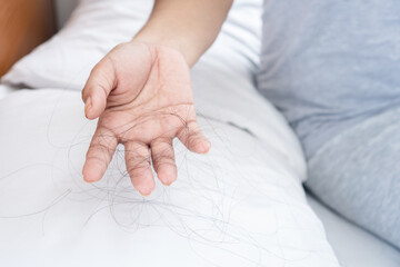 closeup hand holding hair loss fallen on pillow