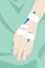 Saline solution on a patient woman's hand. Illustration