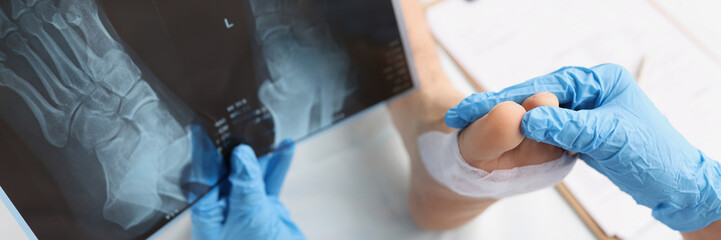 Doctor holds x-ray with dislocated leg of patient lying on table