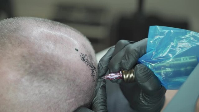 Man in micropigmentation treatment. salon. Making hair on bald scalp. Tattooing head. Hair micro pigmentation. Using professional equipment. Zoom, closeup.