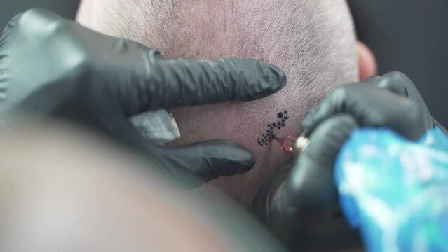 Man in micropigmentation treatment. salon. Making hair on bald scalp. Tattooing head. Hair micro pigmentation. Using professional equipment. Zoom, closeup.