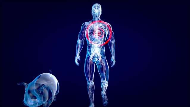 Abstract 3D animation of a pig heart transplantation